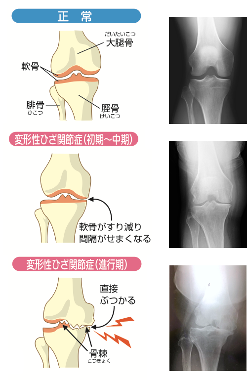 膝関節の臨床 | 白岡 格 |本 | 通販 | Amazon